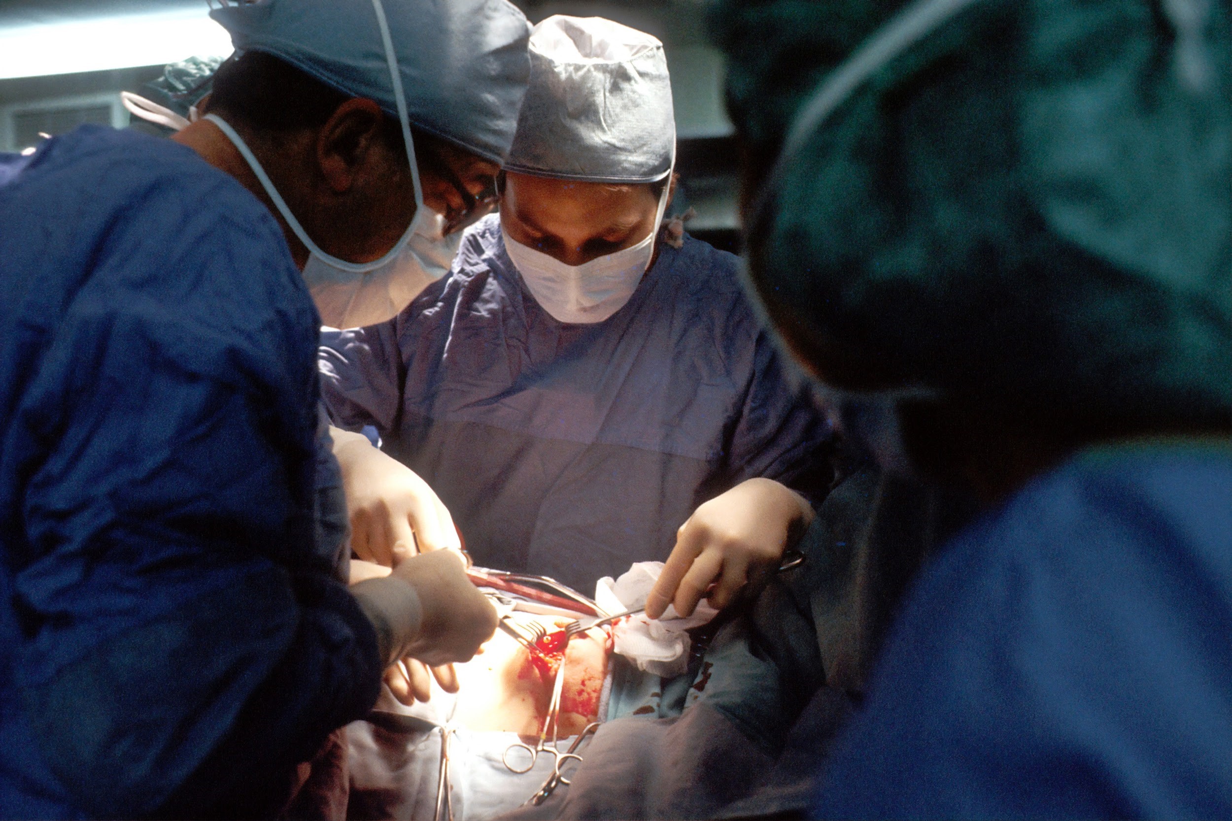 Surgical Errors and Mistakes